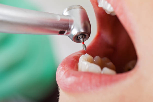 Best Weekend Emergency Dentist in Camp Point, IL